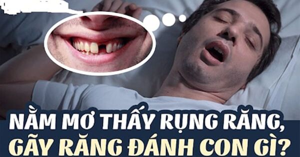 mơ gãy răng đánh đề con gì